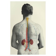 Stampa medica originale d'epoca - Reni, 1900 ca.