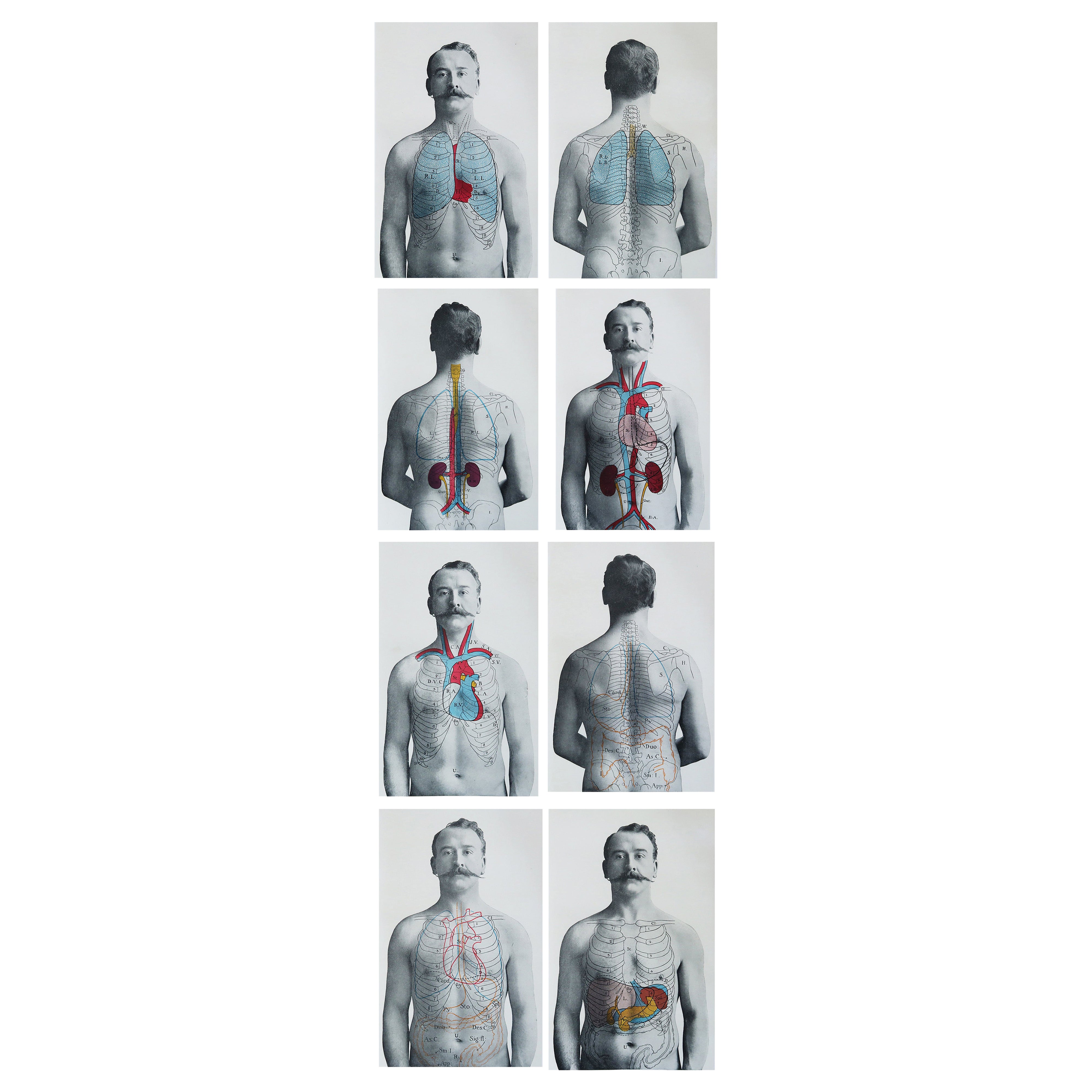 Set of 8 Original Vintage Medical Prints, circa 1900
