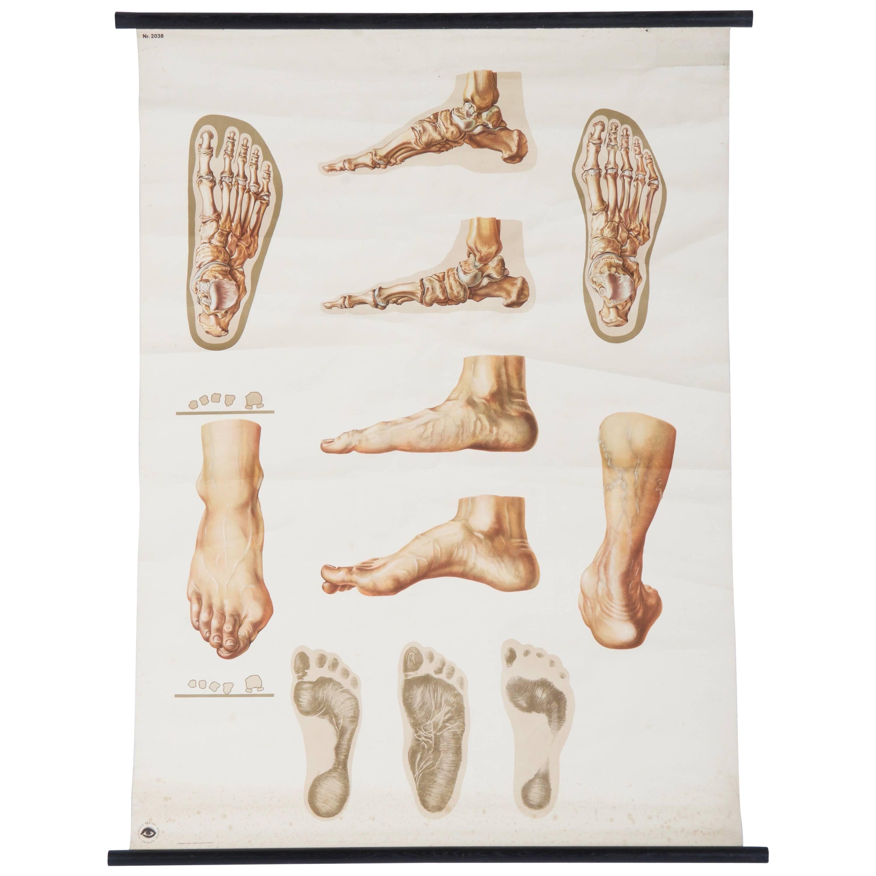 Vintage Large German Medical Chart, Poster "Orthopedics of Foot" For Sale