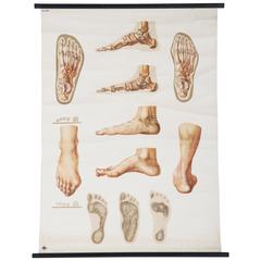 Vintage Large German Medical Chart, Poster "Orthopedics of Foot"