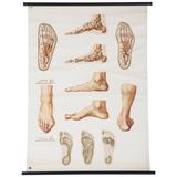 Vieille affiche allemande de médecine, affiche « Orthopedics of Foot »