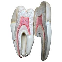 Rare Large Tooth, Object of Study of French School of Dental Medicine