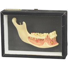 Wax Model Showcase Displaying Dental Health by Hermann Eppler