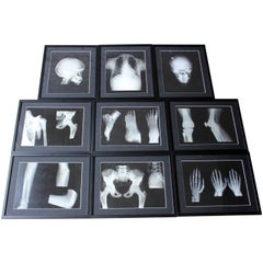 Group of Nine Framed Mid-Century Medical X-Ray Imaging Teaching Aids