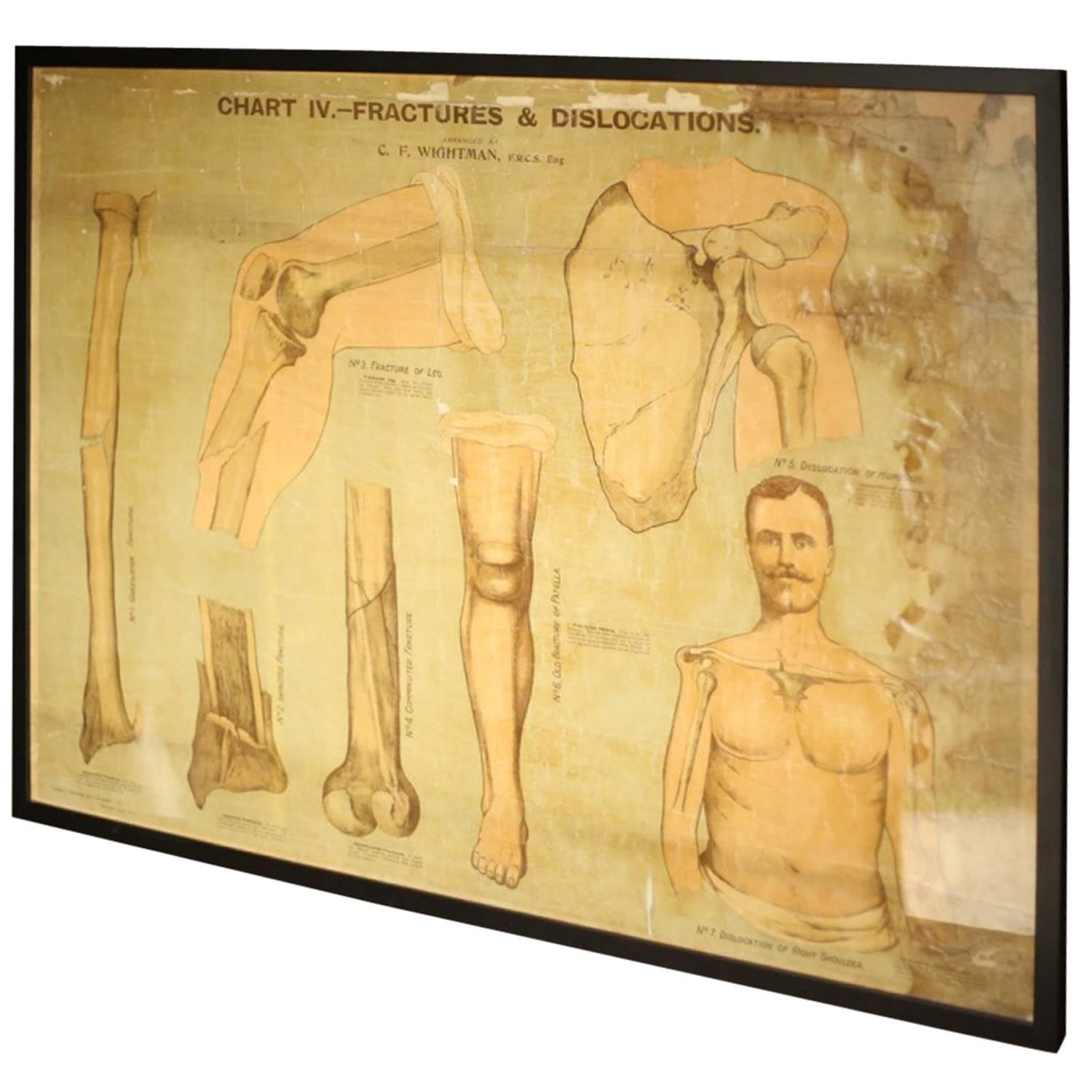 Edwardian Medical Poster of Fractures and Dislocations, Chemist Science