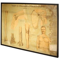 Edwardian Medical Poster of Fractures and Dislocations, Chemist Science