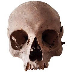 19th Century Antique Human Skull