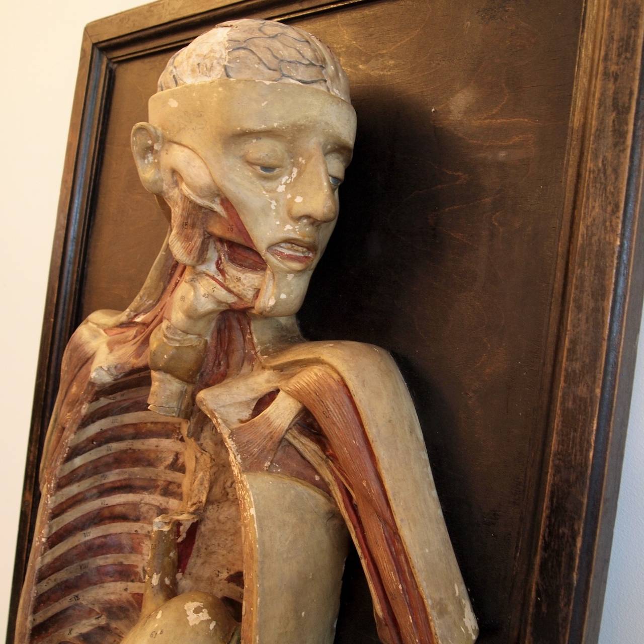 Full torso dissection model, with exposed ribcage, digestive system and brain. Painted plaster on a dark-stained timber backboard.