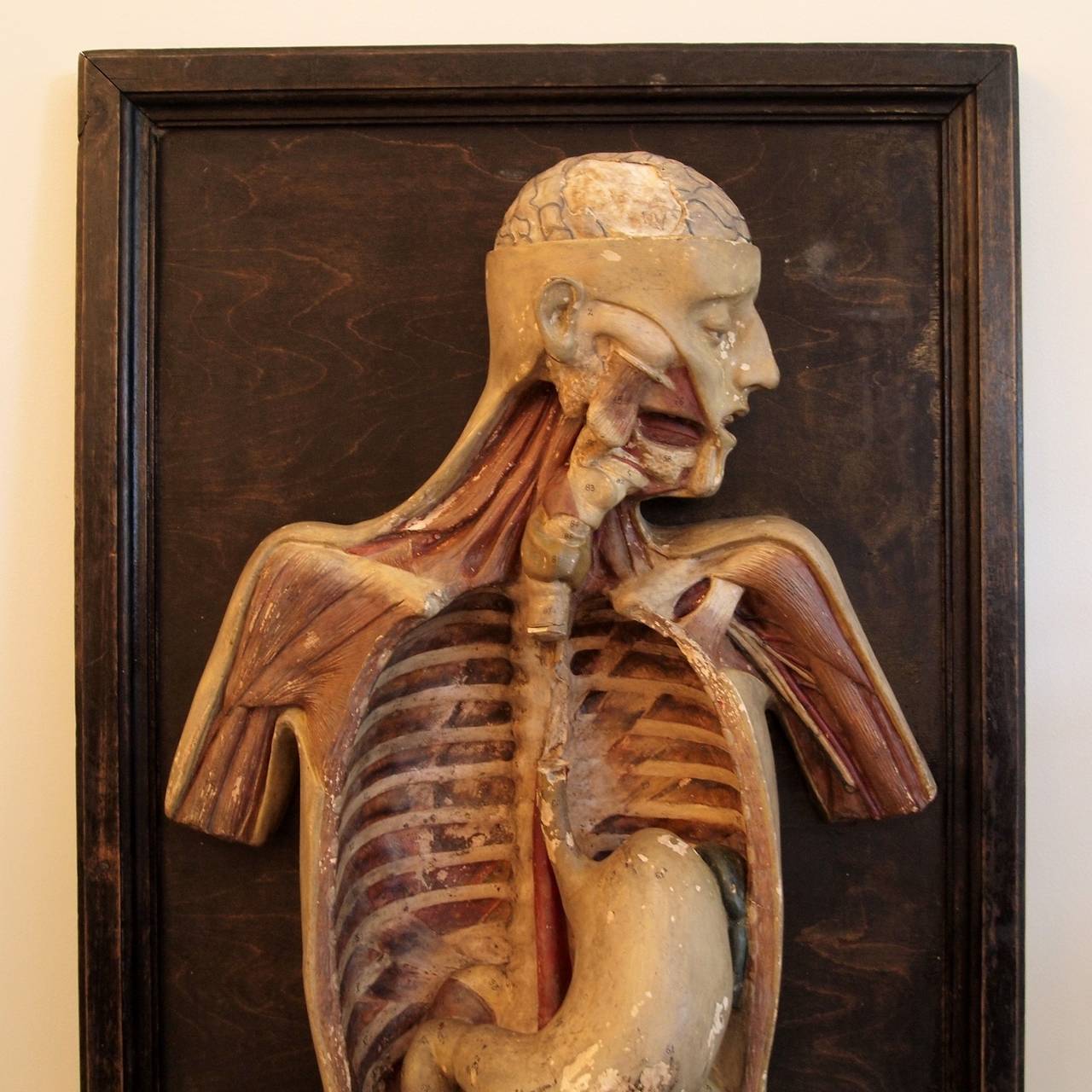 European Victorian Plaster Anatomical Torso Model
