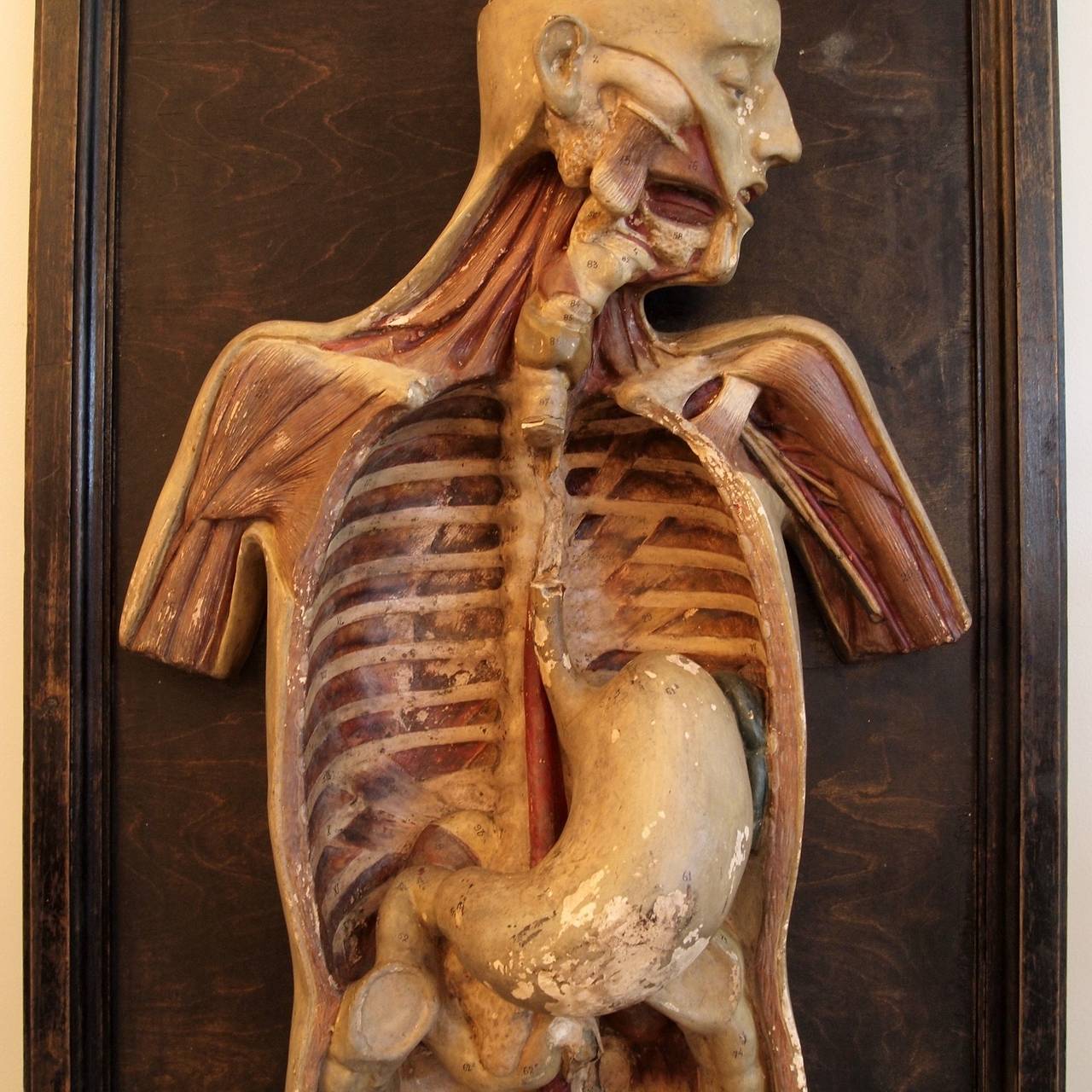 19th Century Victorian Plaster Anatomical Torso Model