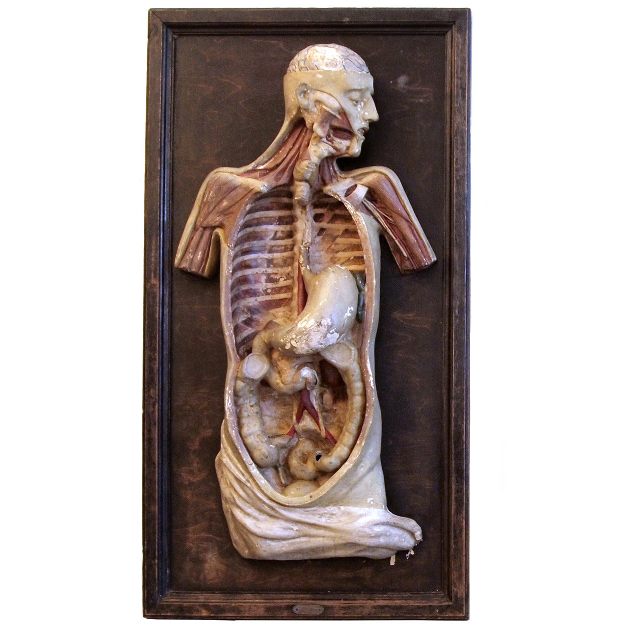 Victorian Plaster Anatomical Torso Model