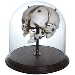 Real Beauchene Skull, Medical School Teaching Display