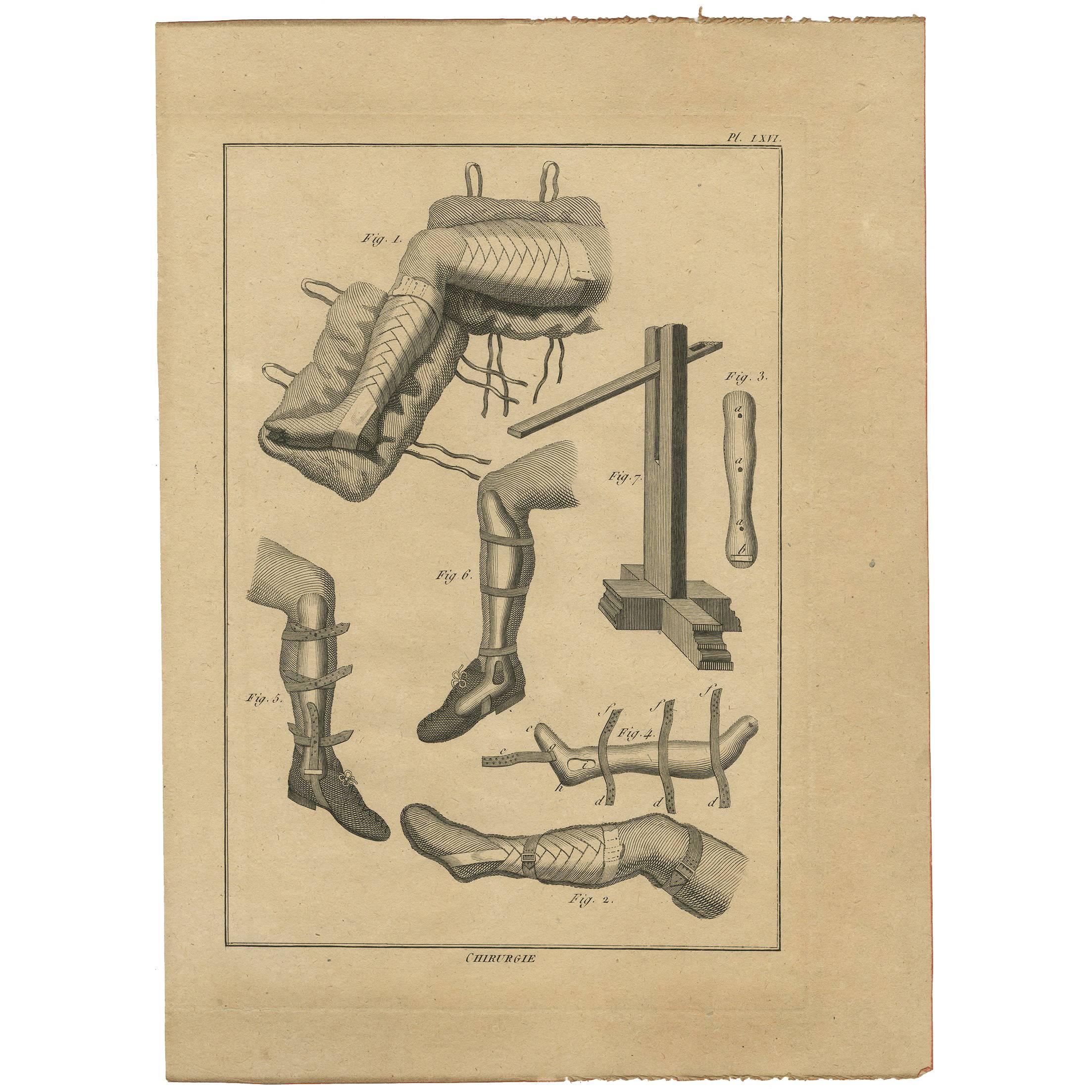 Antique Print of Leg Surgery Techniques by H. Agasse, circa 1798