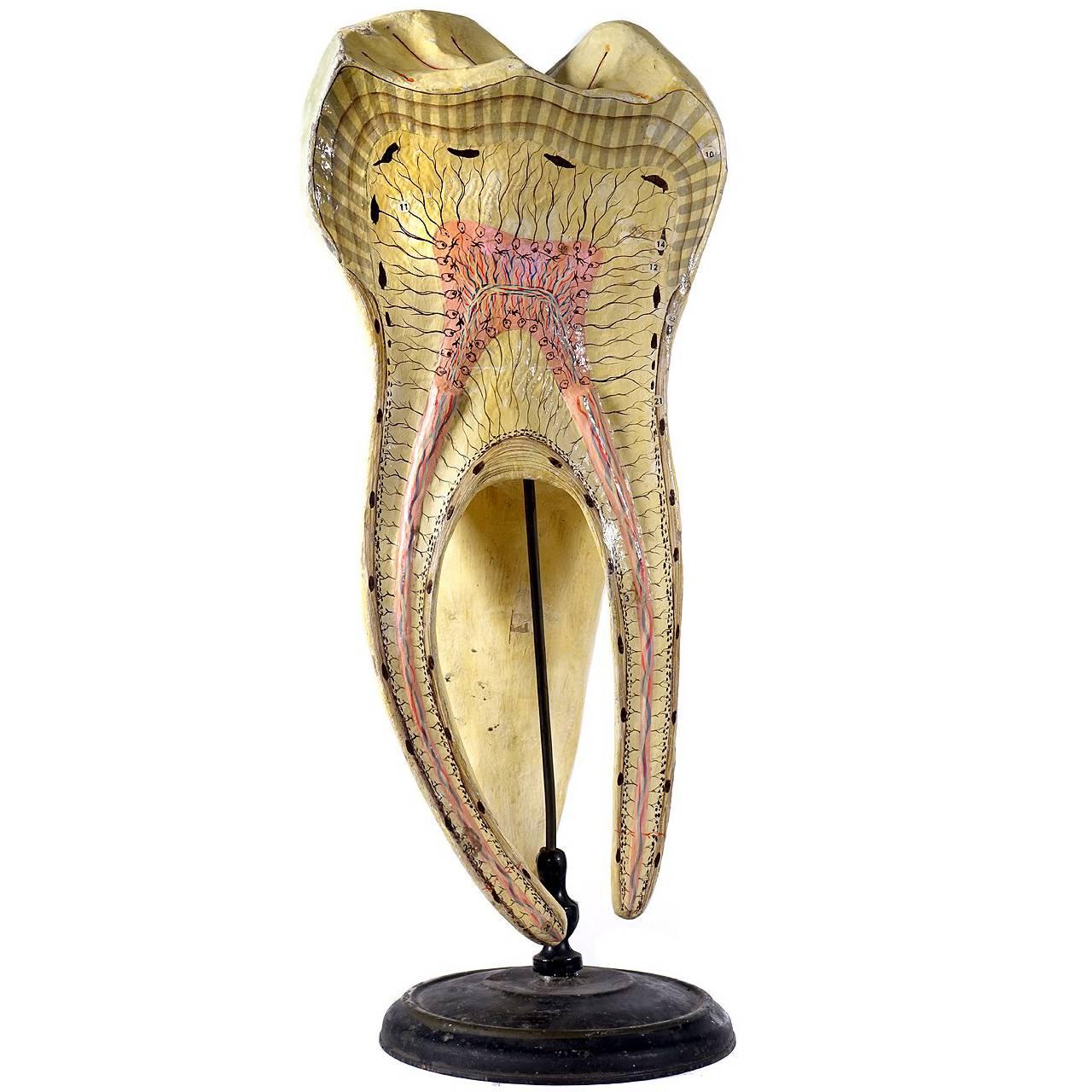 Large Dr. Auzoux Tooth Model