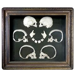 Rare Antique 1800s Sagittal Sectioned Skull 6
