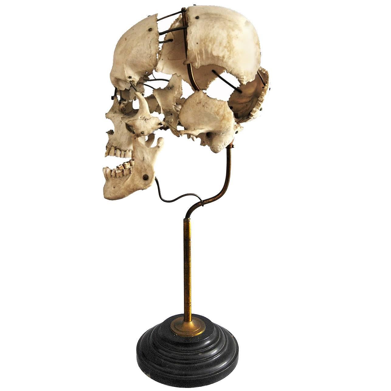 Real Beauchene Skull, Early Medical School Teaching Display