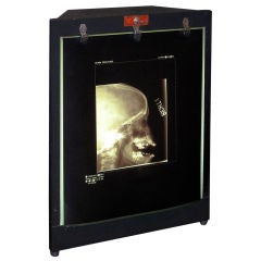 "X-Ray" Lighted Viewer