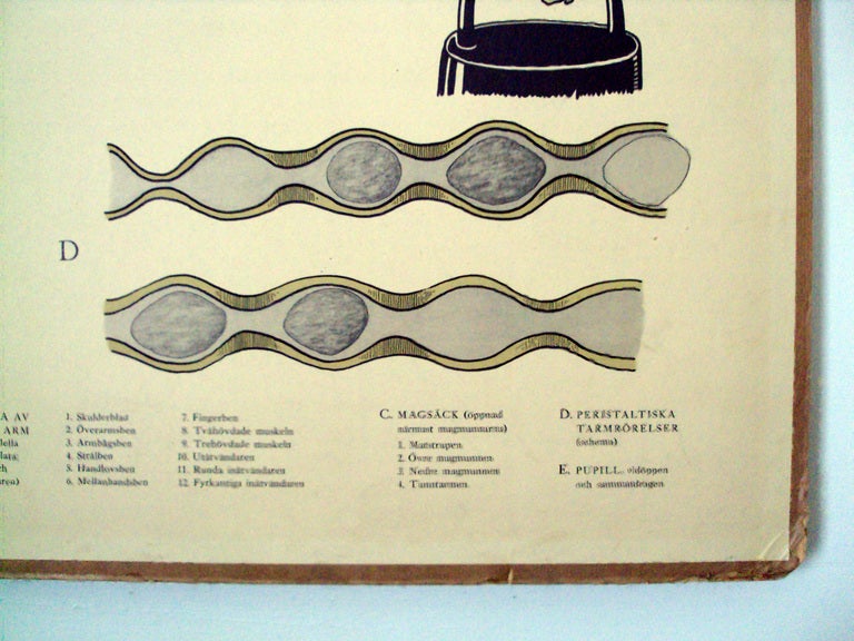 Vintage Swedish Mid-Century Medical Educational Diagram For Sale 1