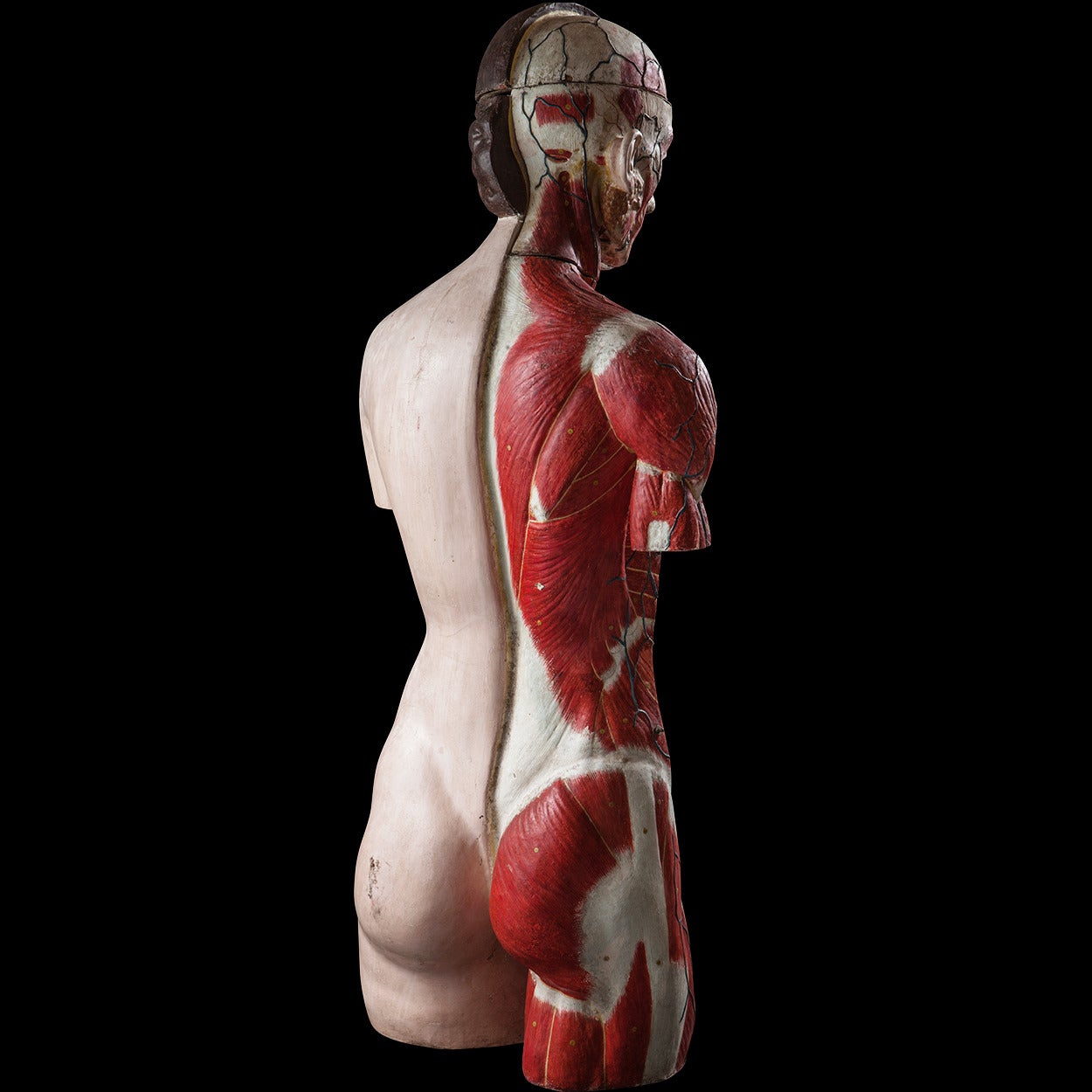 Anatomical Model In Distressed Condition In Culver City, CA