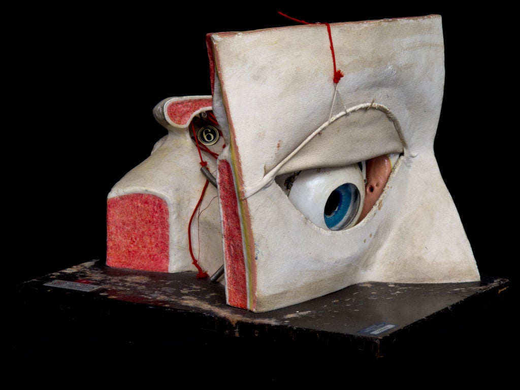 Rare Anatomical Model of Human Eye