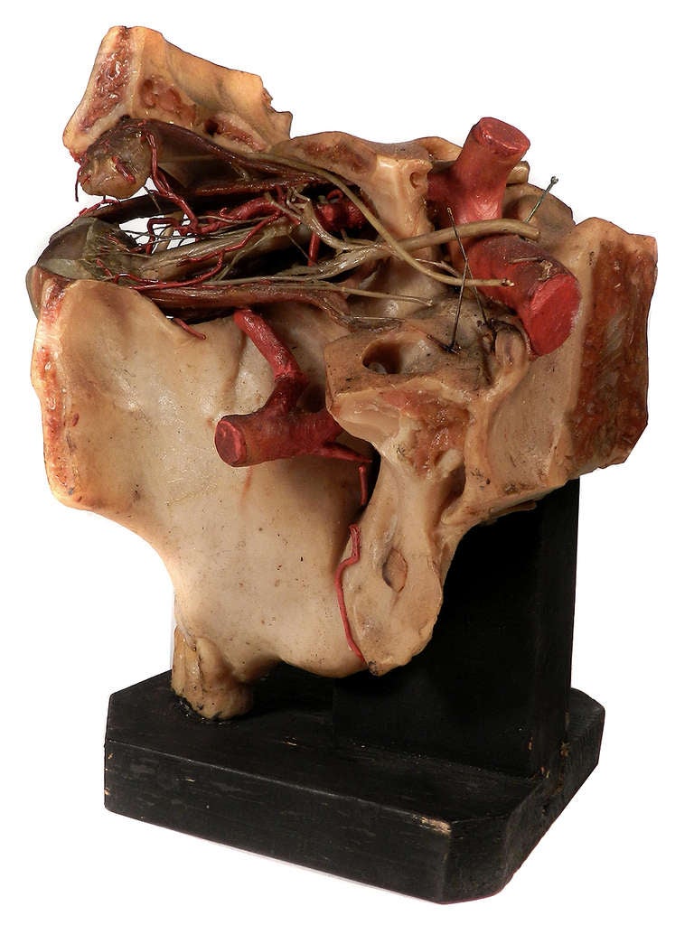 Oversized Wax Anatomical Model - 1800s In Good Condition In Peekskill, NY