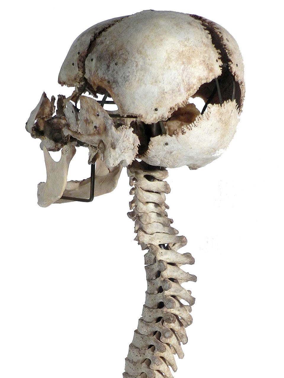 skull and spine