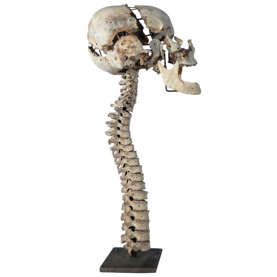 Real Beauchene Skull on Spine, Medical School Teaching Display