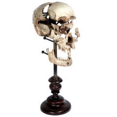 Vintage Real Beauchene Skull - Medical school teaching display.