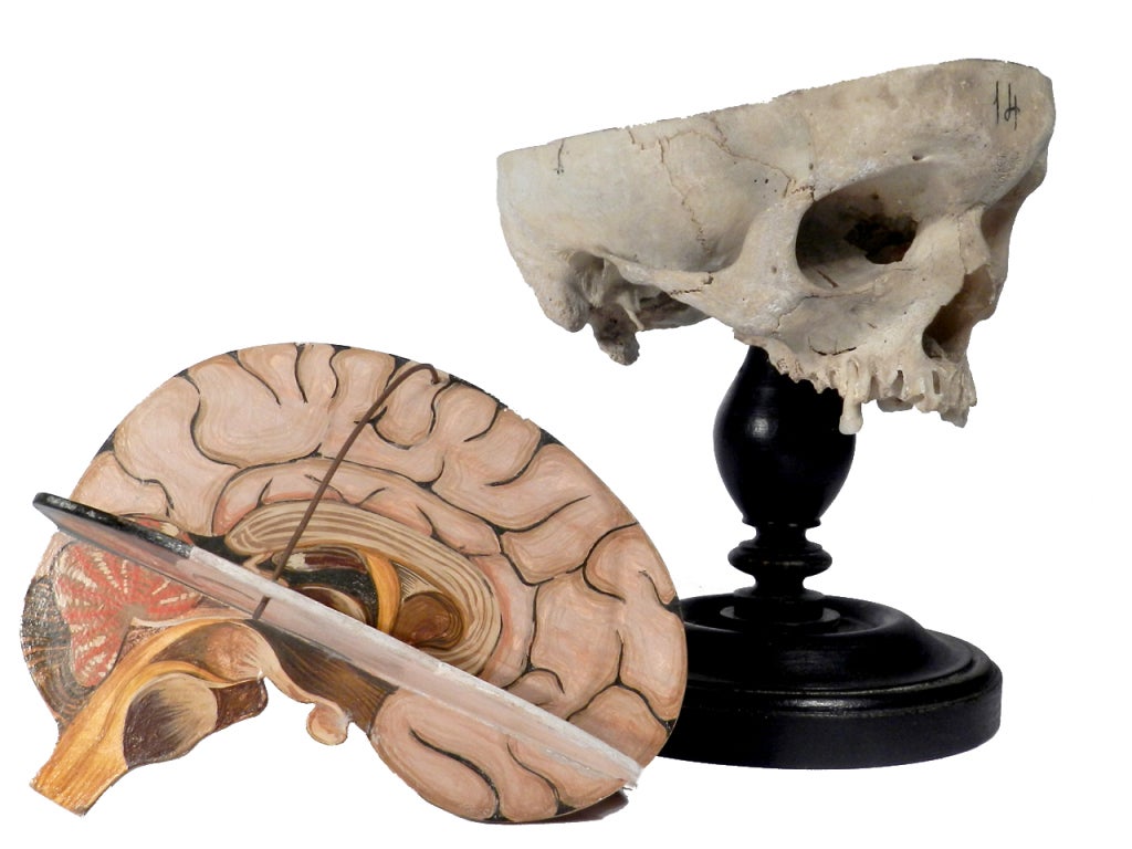 19th Century 1800s Skull with Hand Painted Brain - Teaching Aid