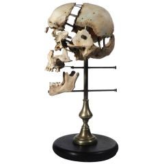 Real Beauchene Skull - Medical school teaching display.