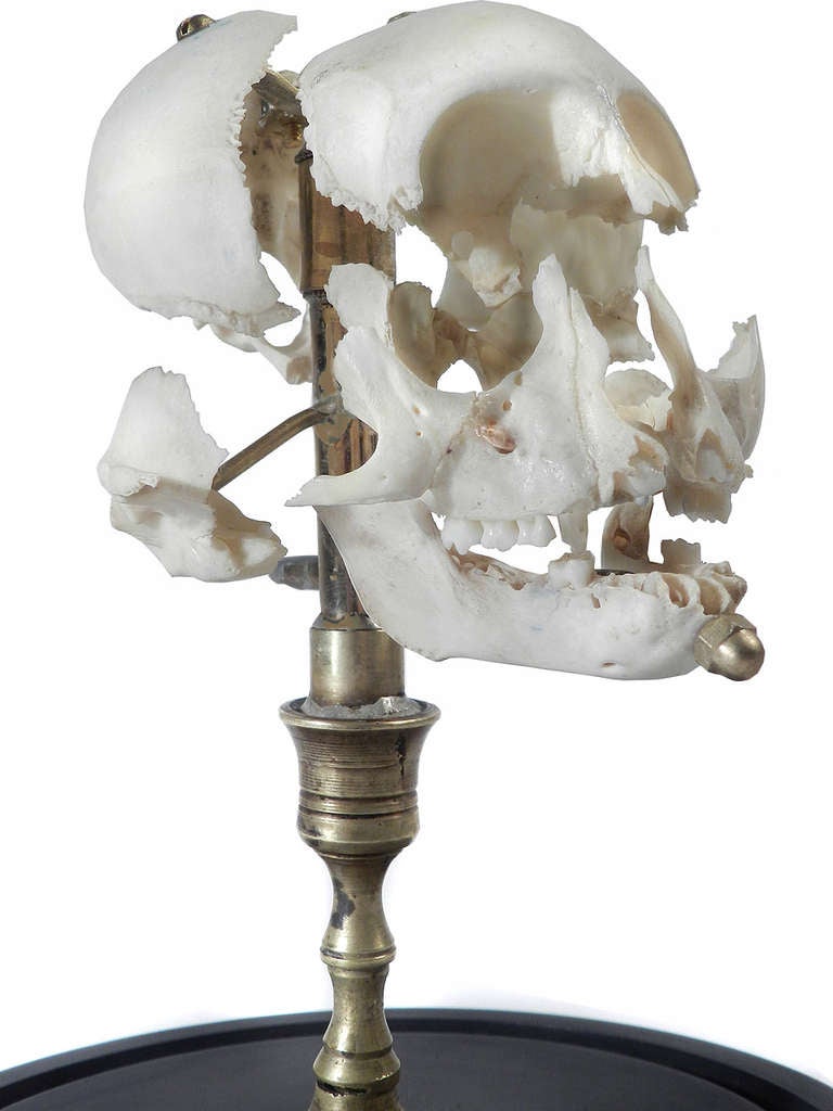 A Beauchene Skull, also known as an exploded skull, is a disarticulated skull that has been painstakingly reassembled on a stand with jointed supports for studying of the skull as a whole or each piece individually. In the mid-1800s French anatomist