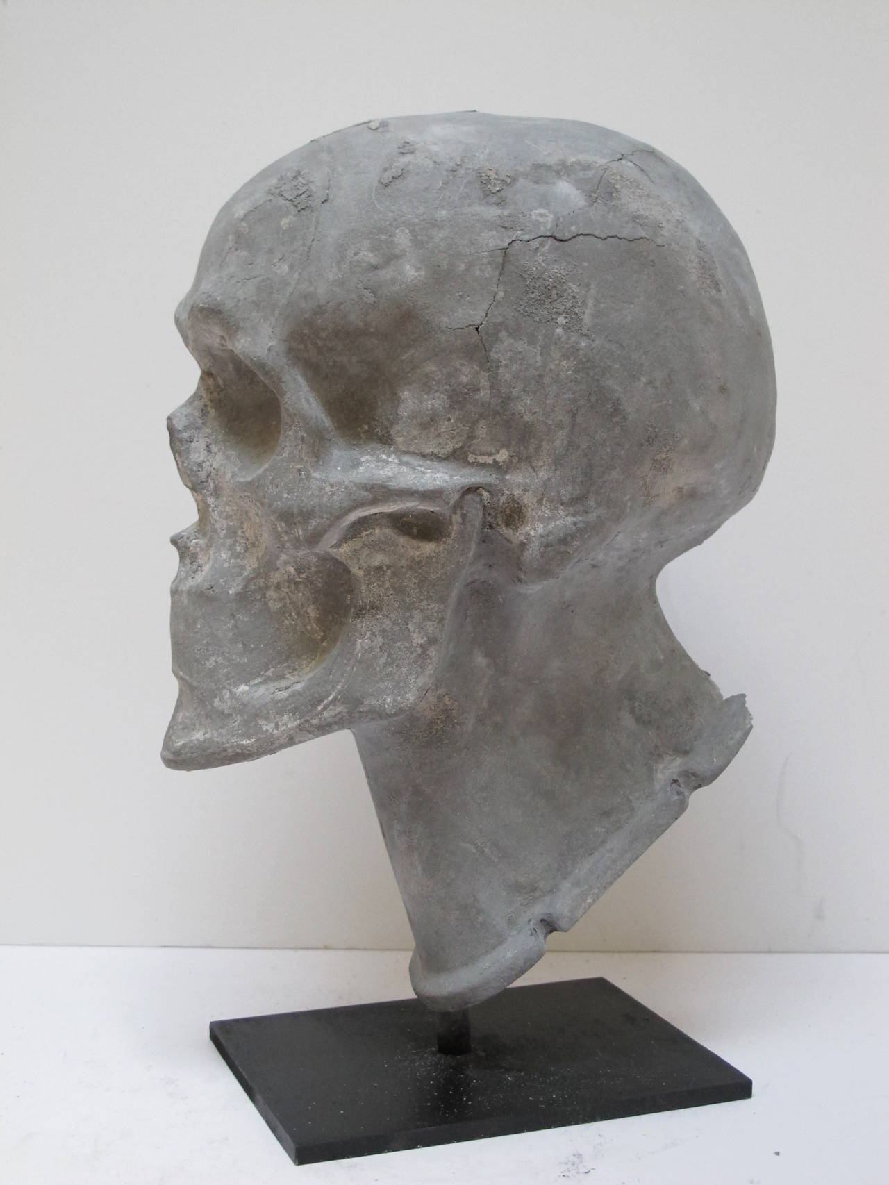 Hollow cast zinc or aluminum skull made as a teaching aid. The finely detailed skull would be used as a forensics teaching model. Mounted on an American primitive metal base.