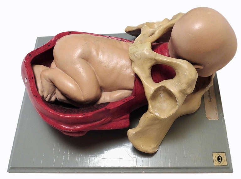 German Anatomical Model of Childbirth with Fetus in Cephalic Position
