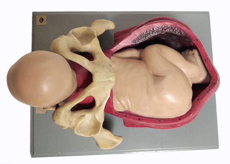 Anatomical Model of Childbirth with Fetus in Cephalic Position In Good Condition In Milan, IT