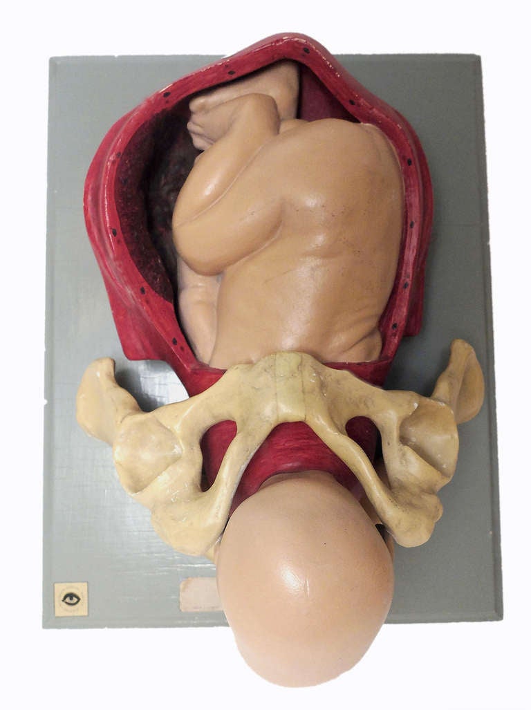19th Century Anatomical Model of Childbirth with Fetus in Cephalic Position
