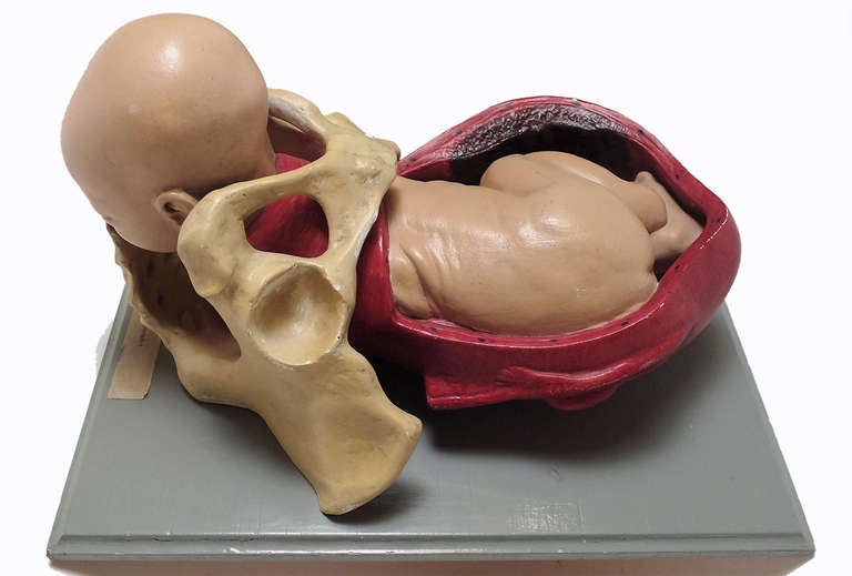 Wood Anatomical Model of Childbirth with Fetus in Cephalic Position