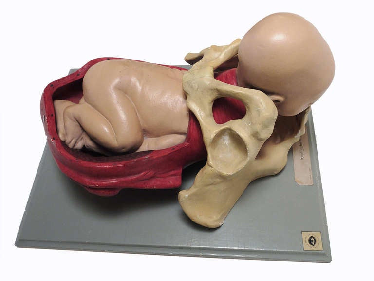 Anatomical Model of Childbirth with Fetus in Cephalic Position 1