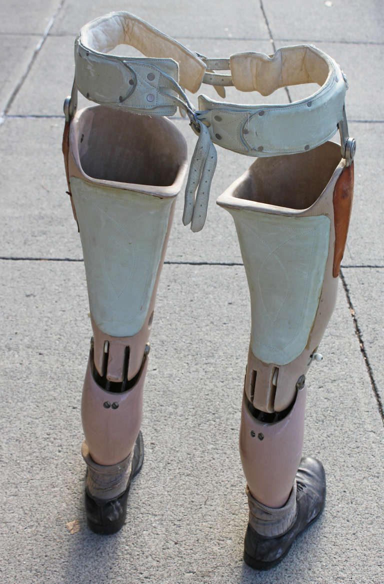 silesian belt prosthetics