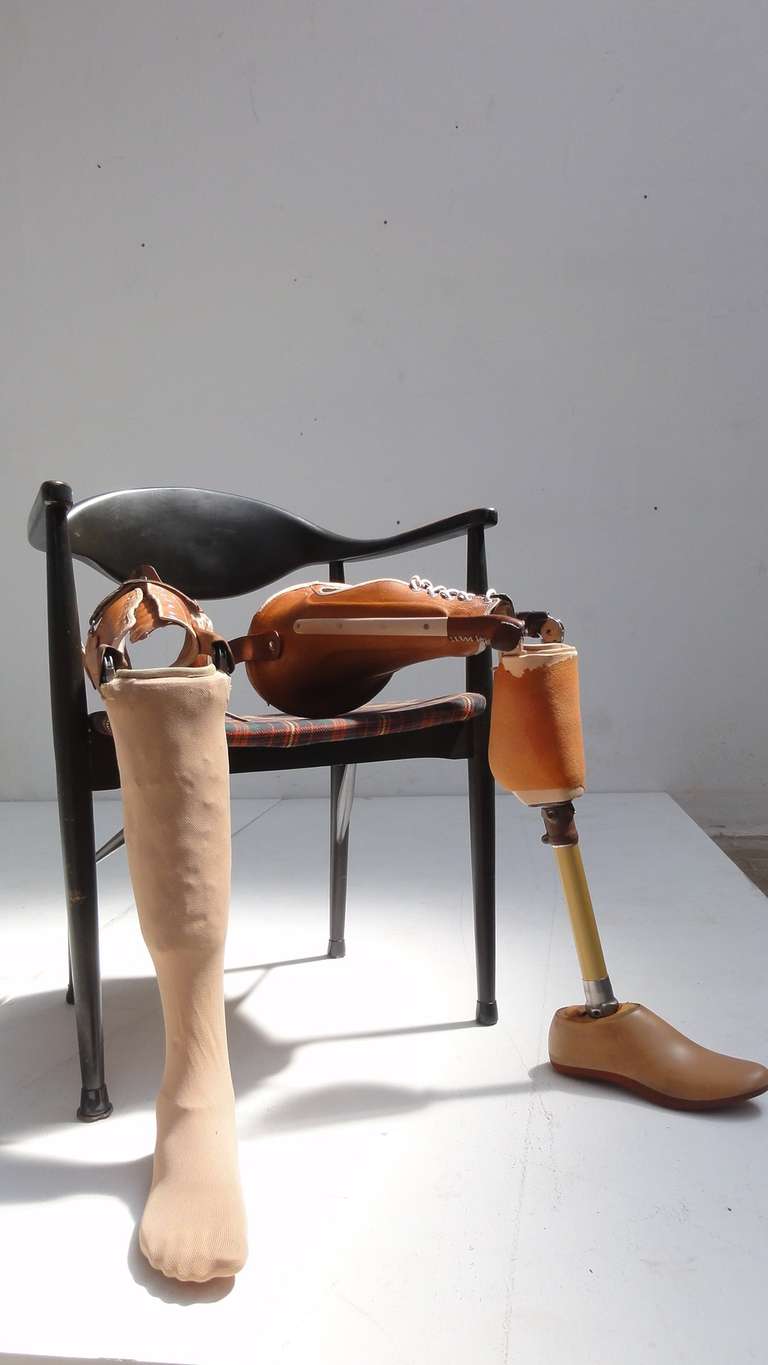1950s prosthetic leg