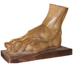 1940s Foot in Plaster