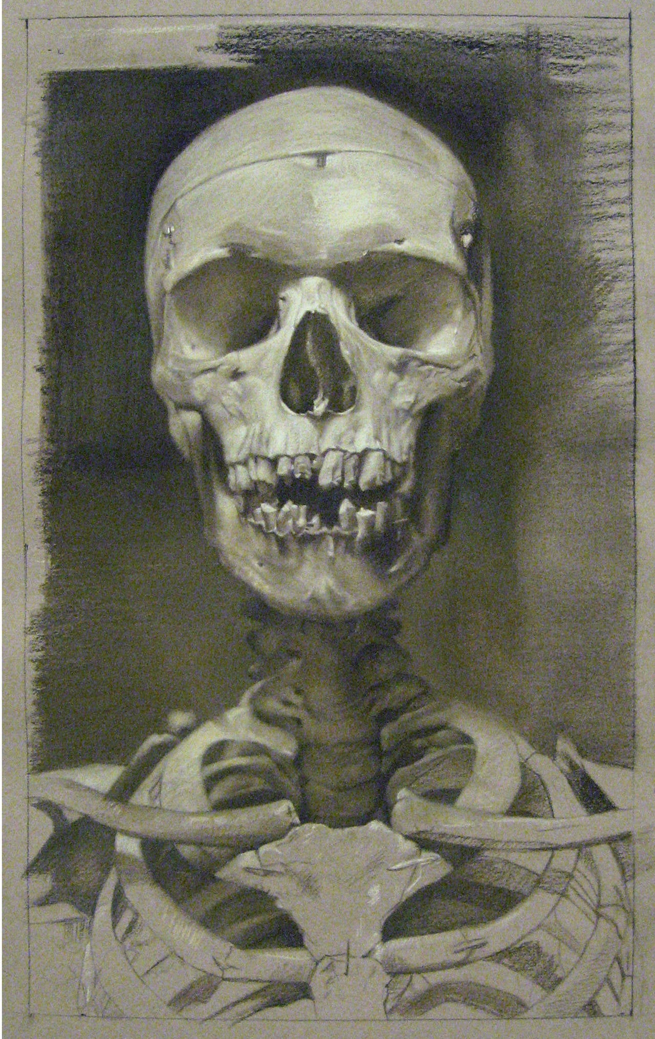 ANATOMY STUDY IN SEPIA, portrait of human skeleton, bones, damaged teeth - Art by David Kassan