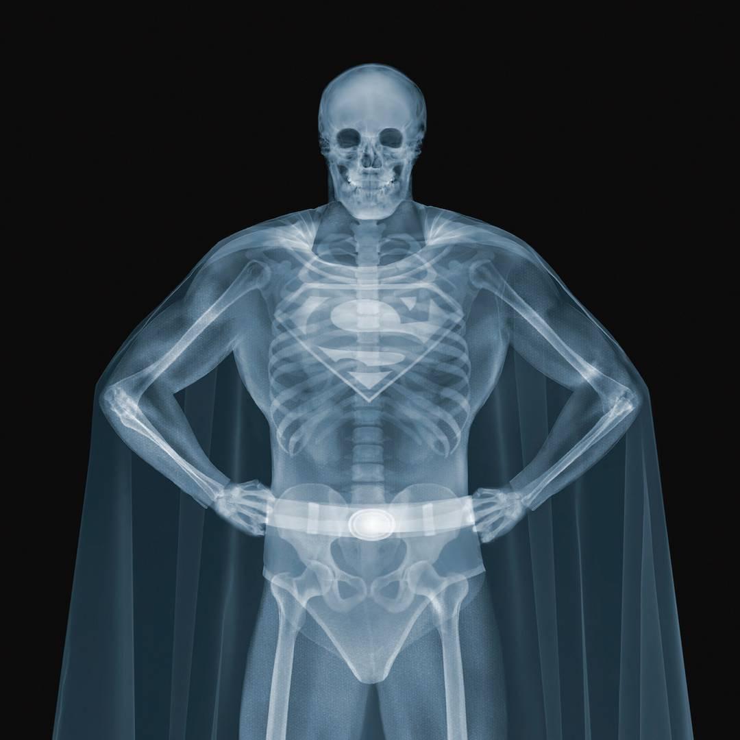 Nick Veasey - Superman For Sale at 1stdibs