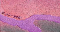 Pop-Art-Gemälde "Outside Choice" von Michael Knigin