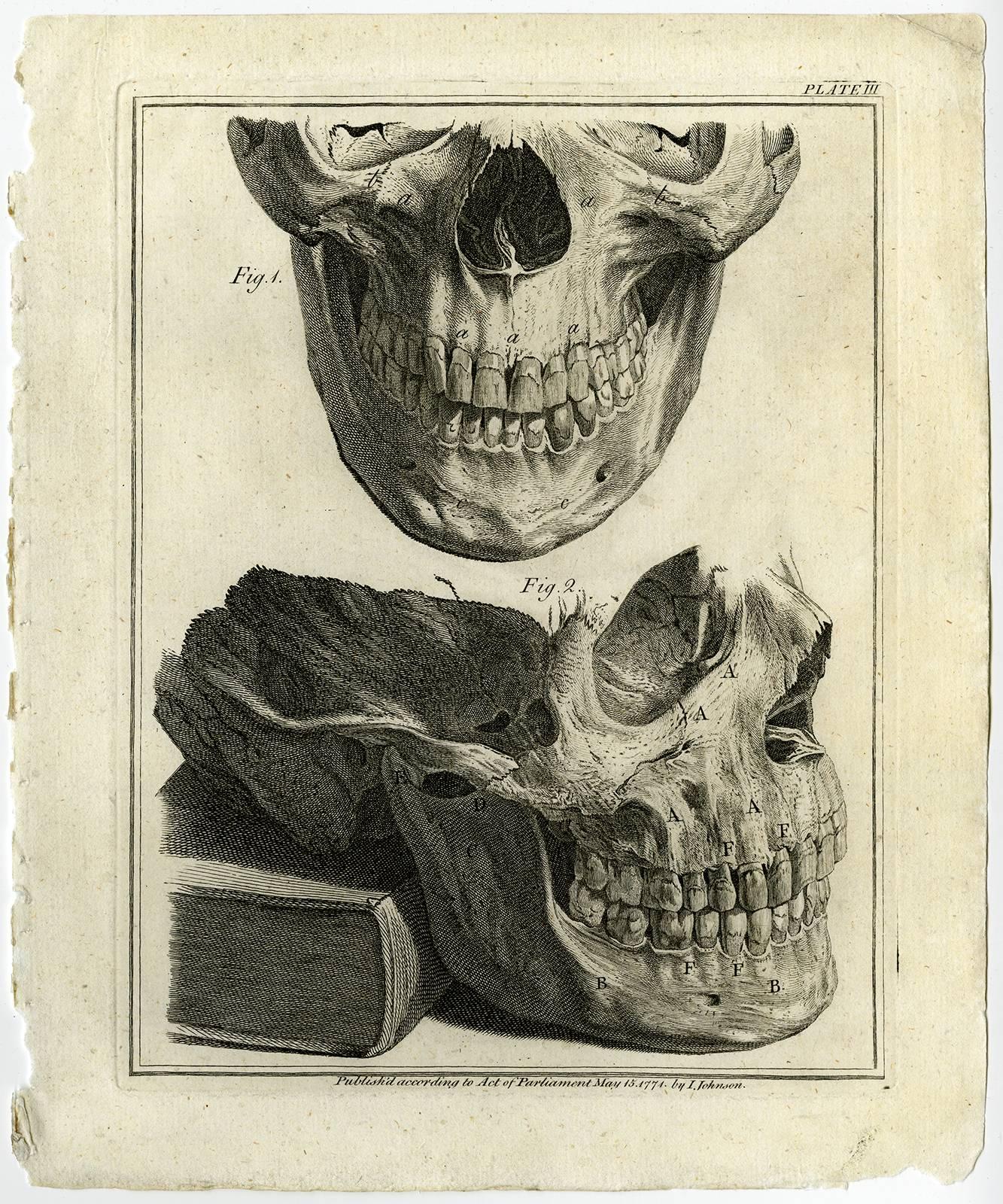 Historia naturalis dentium humanorum […]. - Beige Print by Ignace Fougeron