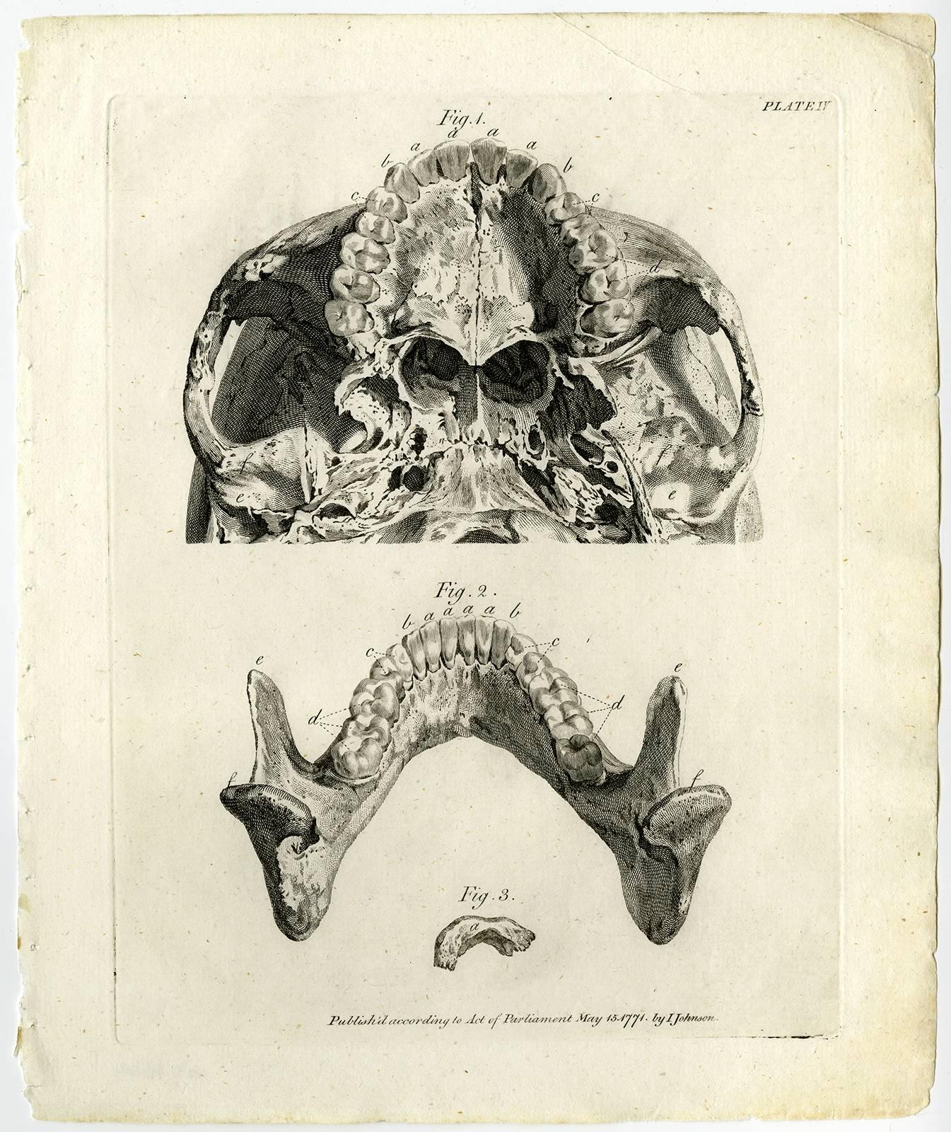 Copperplate engraving. on hand laid (verge) paper.

16 Antique prints, titled: 'Historia naturalis dentium humanorum [...]. Natuurlyke Historie der Tanden van den Mensch …' - ('A natural history of the human teeth ... '). A set of 16 very detailed