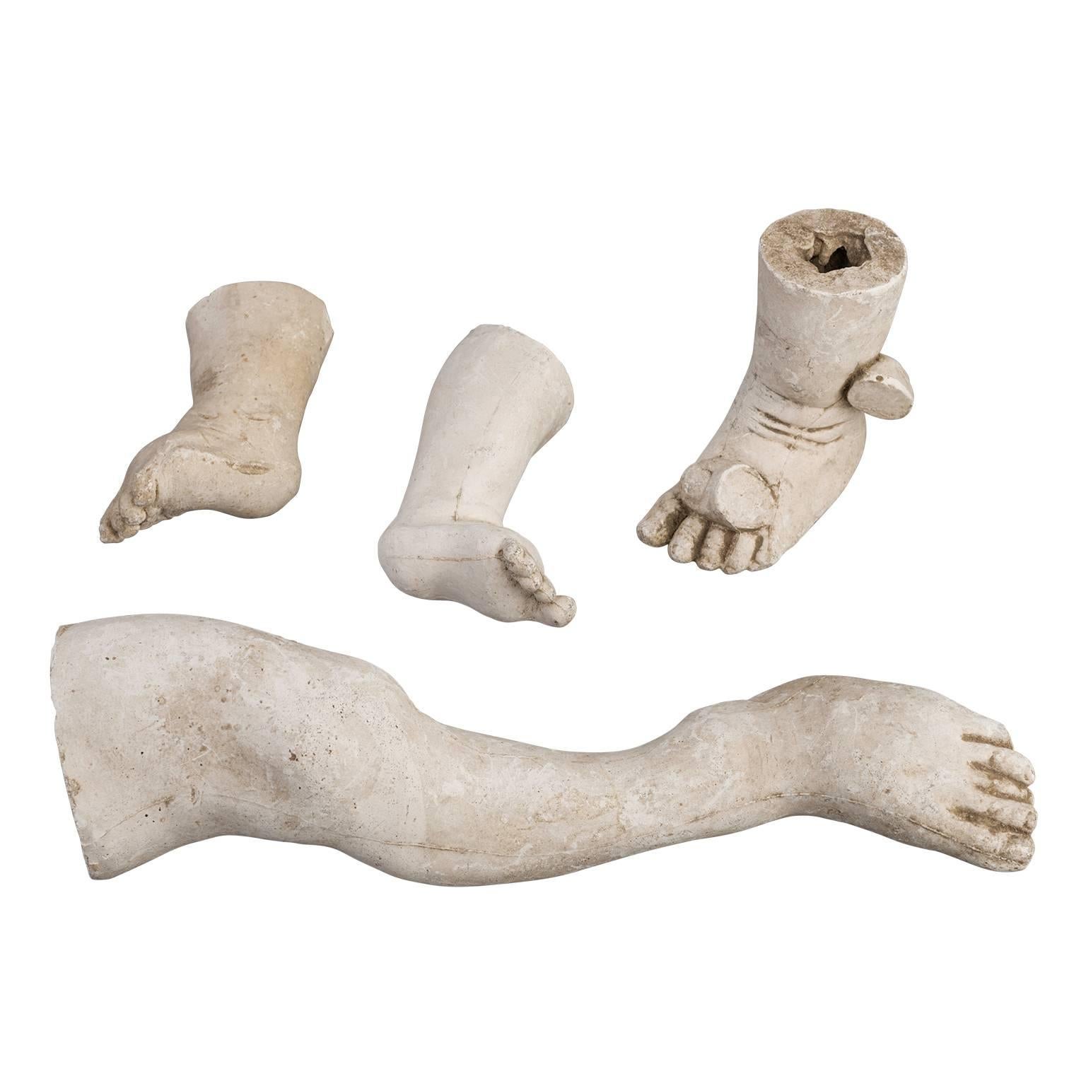 Orthopedic Casts of Children, 1900-1930 For Sale