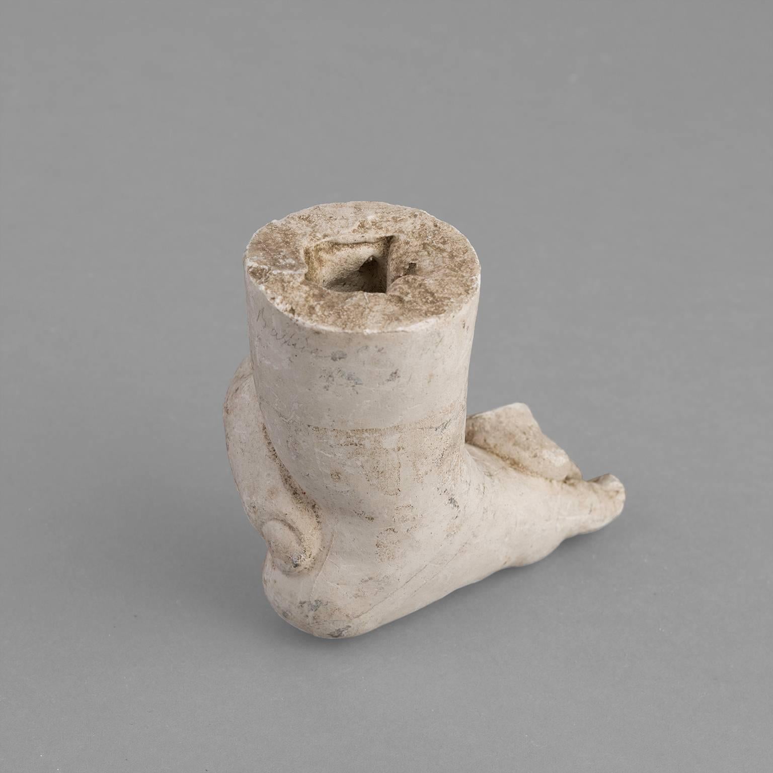 Orthopedic Casts of Children, 1900-1930 For Sale 1