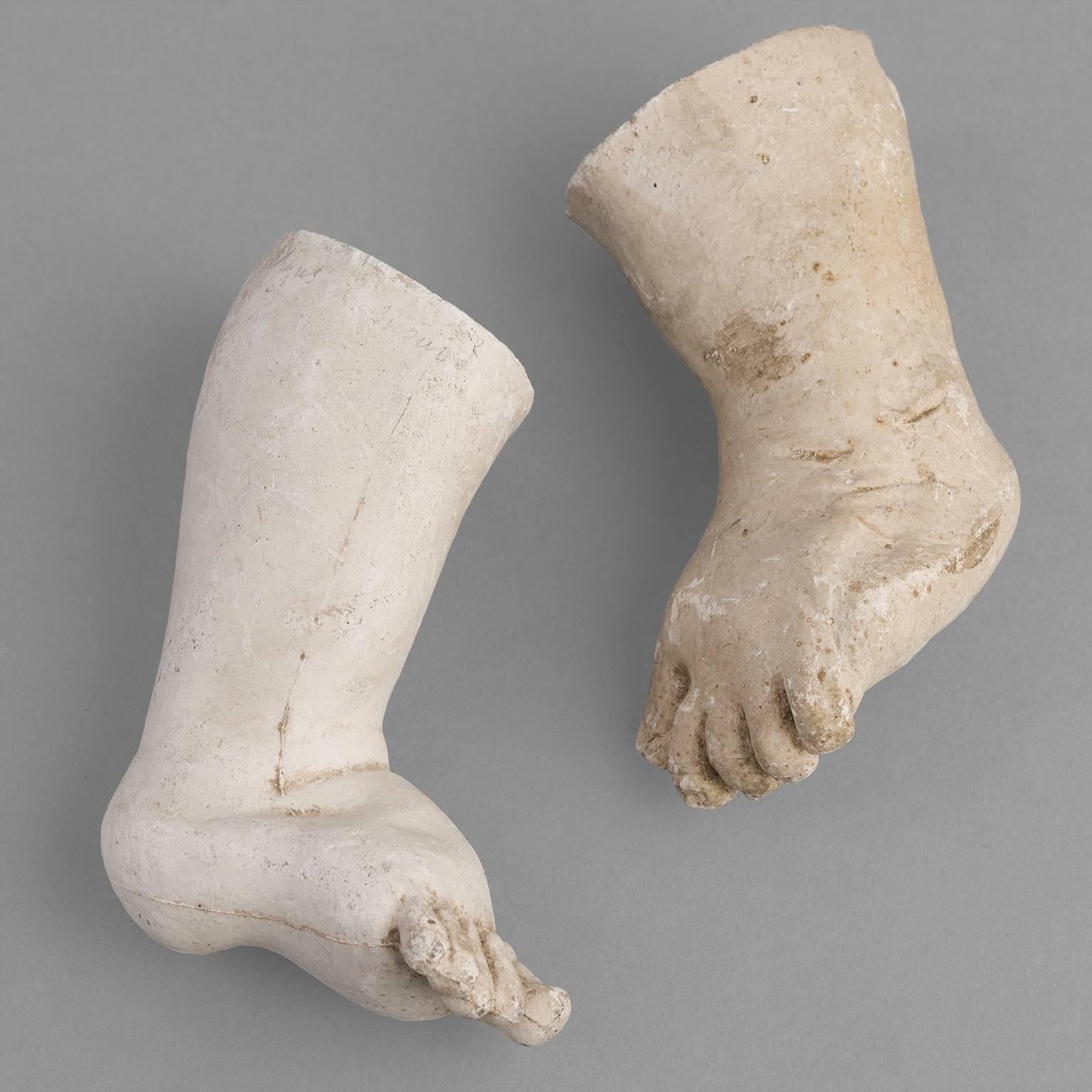 Orthopedic Casts of Children, 1900-1930 In Good Condition For Sale In Saint-Ouen, FR