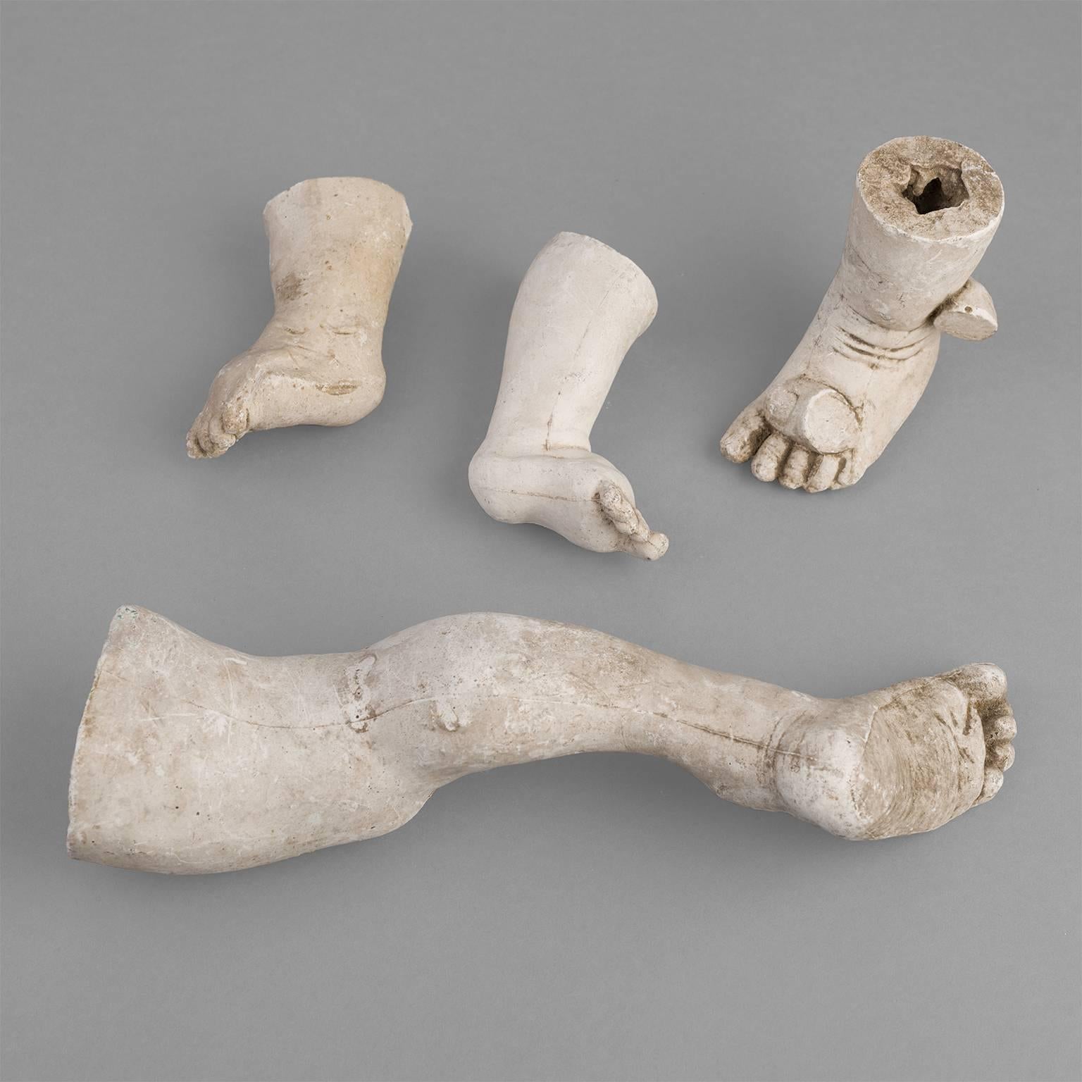 French Orthopedic Casts of Children, 1900-1930 For Sale