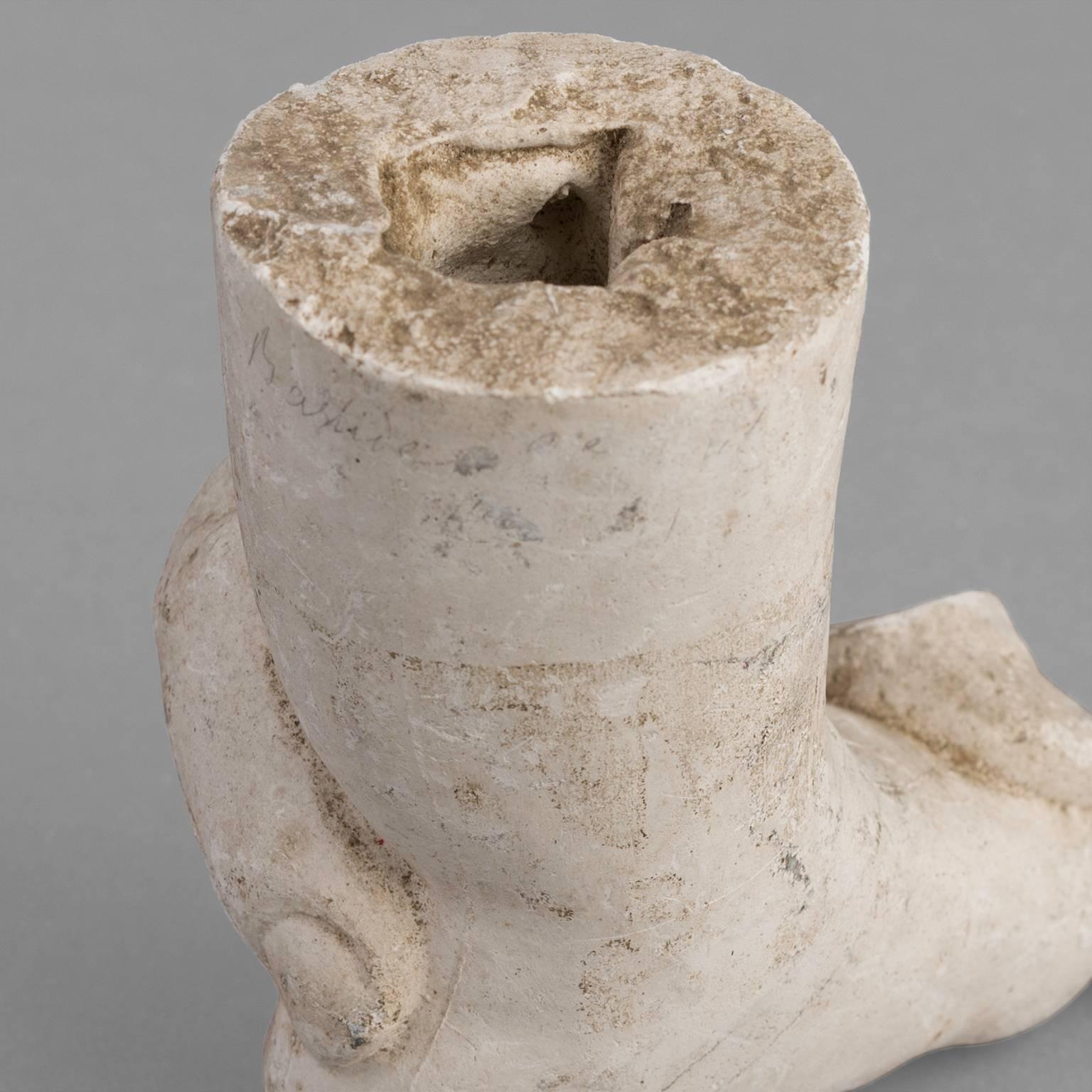 Orthopedic Casts of Children, 1900-1930 For Sale 2